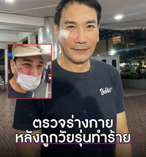 ทูนหิรัญทรัพย์ อดีตพระเอกดัง ถูกโจ๋วัย 17 ย่านคลองถมพลาซ่า ต่อยหน้า