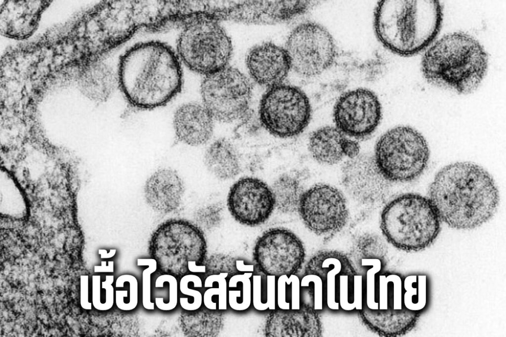 เชื้อไวรัสฮันตา